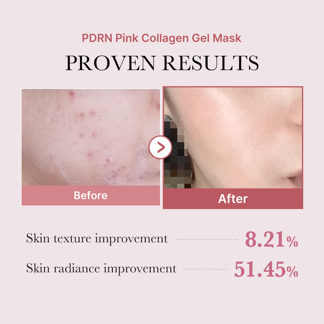 Salmon PDRN Pink Collagen Jelly Gel Mask (4ea)